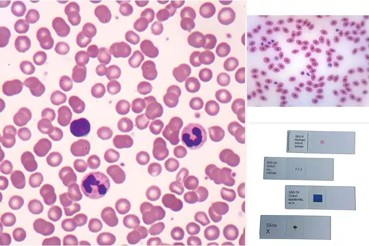 Detailed view of Best Blood Smears for Education: Enhance Your Learning Today