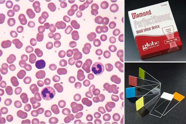 Detailed view of Best Blood Smears for Microscopy
