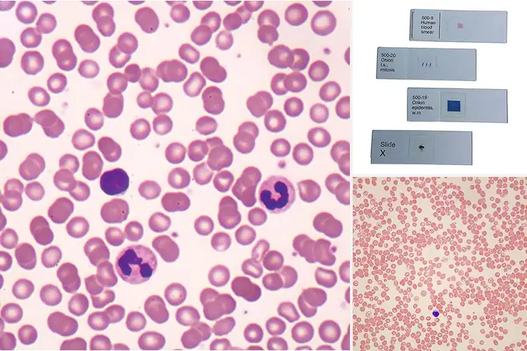 Detailed view of Best Human Blood Smear Slide