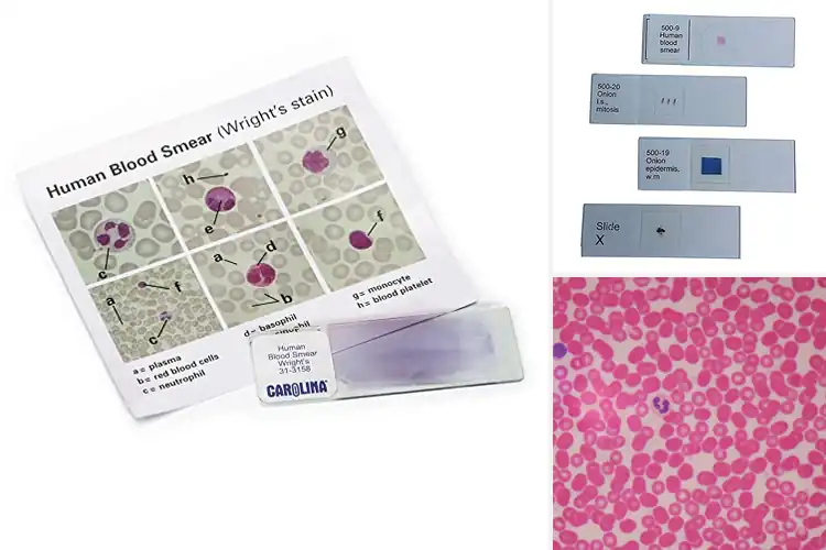 Detailed view of Best Human Blood Smears