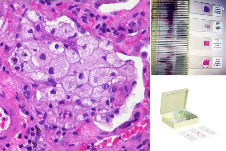 Detailed view of Best Human Pathology Slides