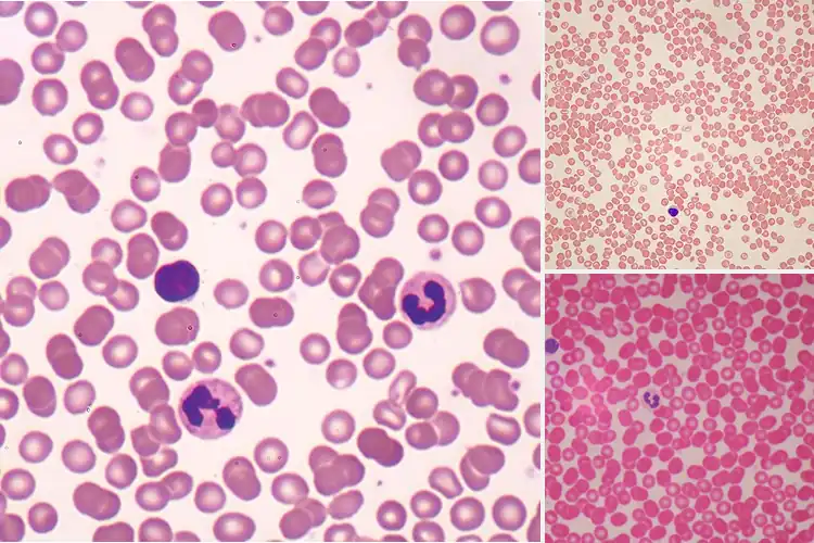Detailed view of Best Human Smears: Clear, Sharp Slides for Easy Learning
