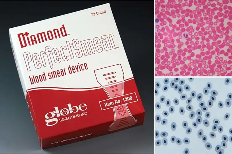 Detailed view of Best Laboratory Blood Smears For Education