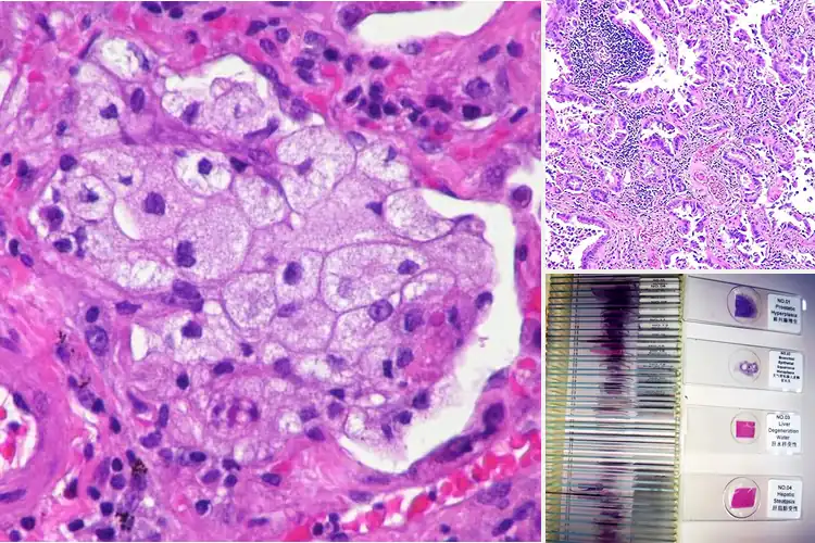 Detailed view of Best Medical Pathology Prepared Slides