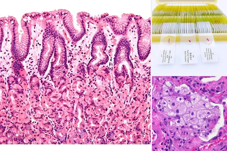 Detailed view of Best Medical Teaching Slides