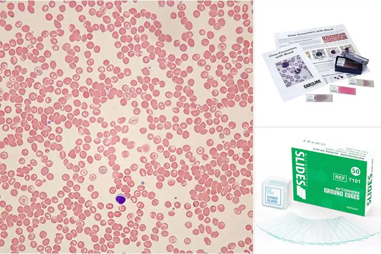 Detailed view of Best Microscope Slides For Sickle Cell Anemia