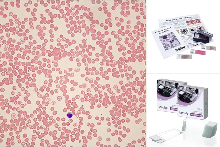 Detailed view of Best Microscope Slides for Sickle Cell Anemias