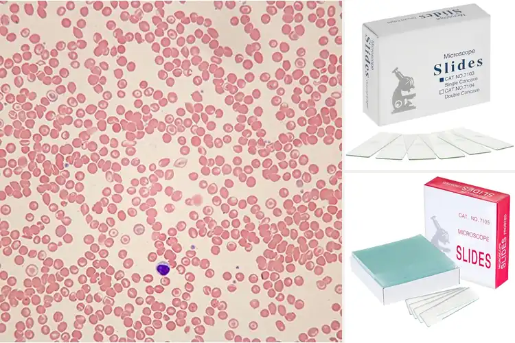 Detailed view of Best Sickle Cell Anemia Microscope Slides
