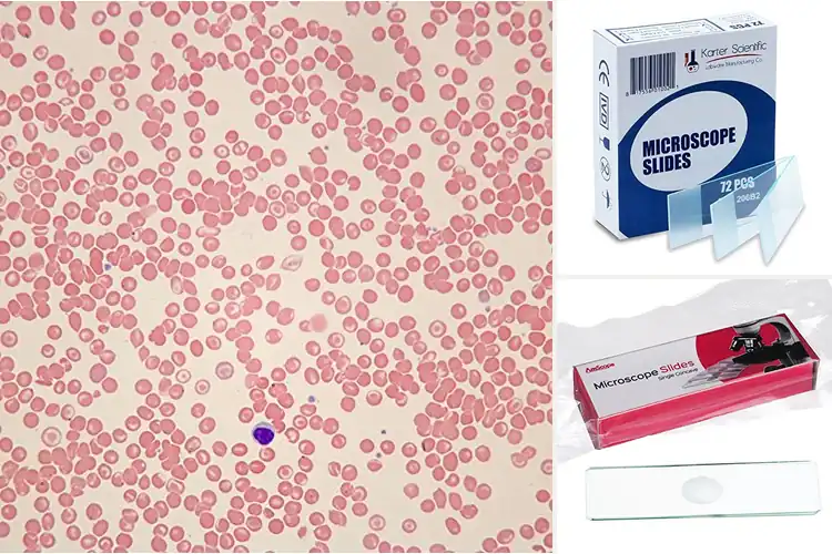 Detailed view of Best Sickle Cell Microscope Slides