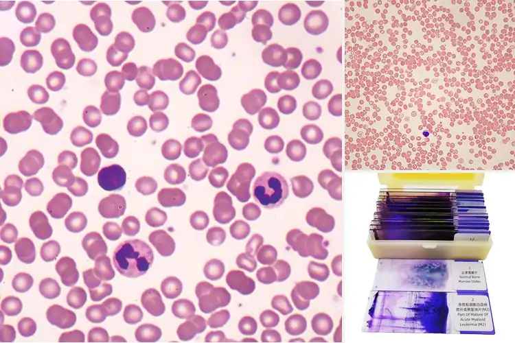 Detailed view of Best Stained Blood Smear Slides