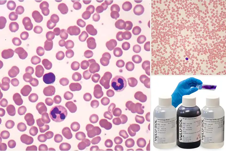 Detailed view of Best Wright’s Stain Blood Smear Slides