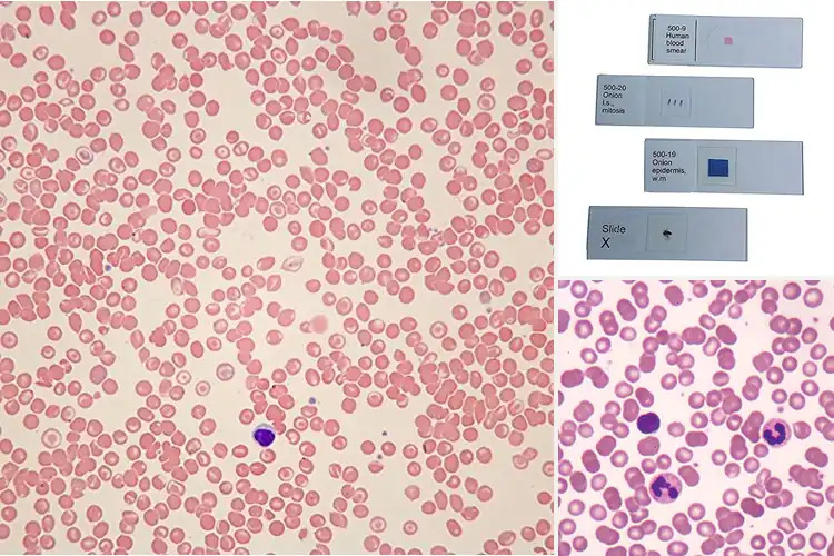 Detailed view of Best Wright’s Stain Slides